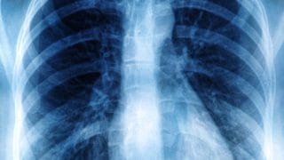 Radiografiile