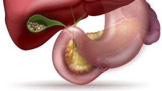 bila, vezica biliara, Uno Bil,