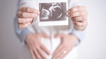 celule stem, nastere,