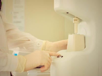 Rigenera, artroza, alopecie, cicatrice, celule progenitorii,