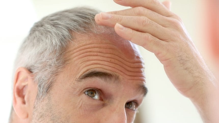 tratament alopecie, alopecia, celule progenitoare, Rigenera,