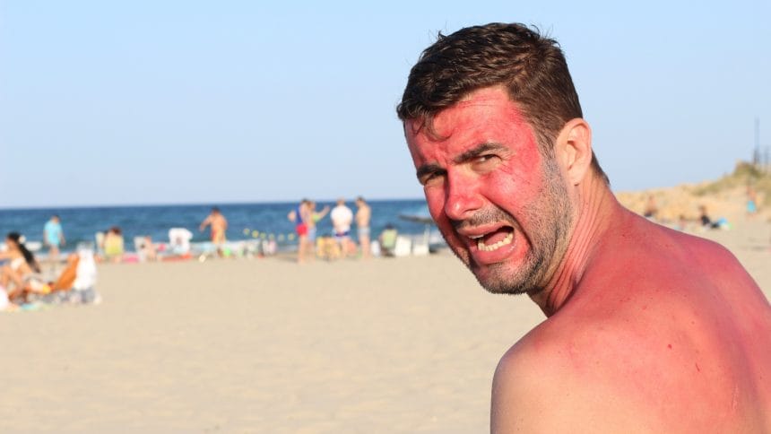 insolatia, hipertermia,