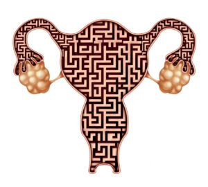 Infertilitate feminina