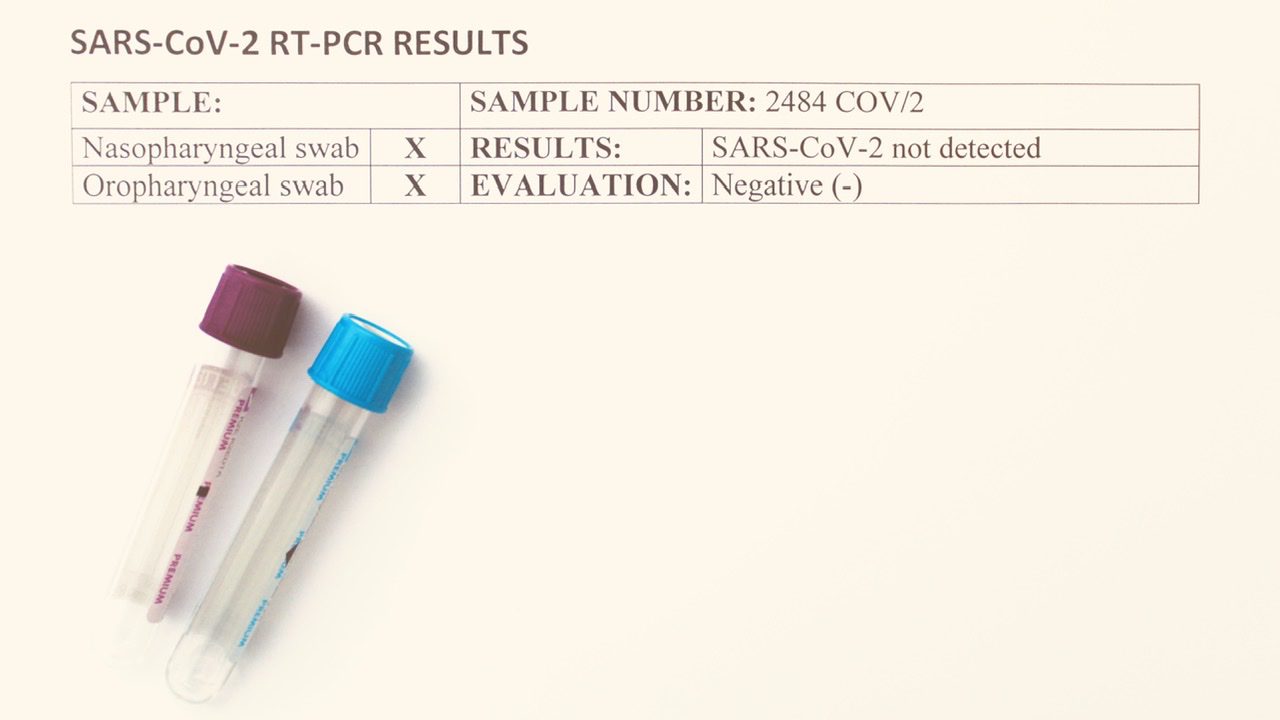 Rezultat negativ SARS-CoV-2