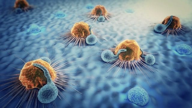 Leucocite atacand celule tumorale