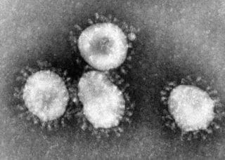 Coronavirusul SARS-CoV-2 la microscopul electronic