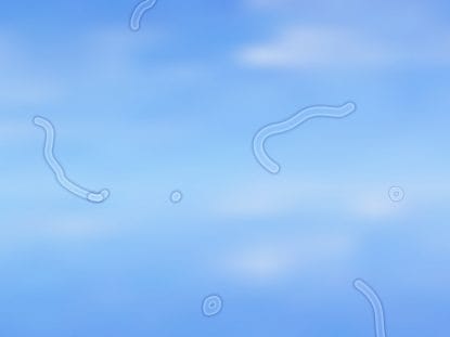 vederea incetosata, miodezopsie,