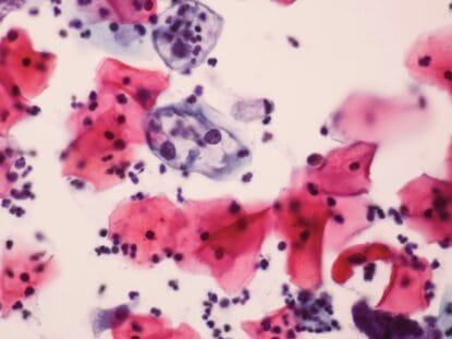 Celule modificate, HPV,