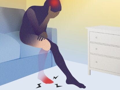 membru fantoma, durere fantoma