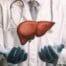 Transplantul hepatic