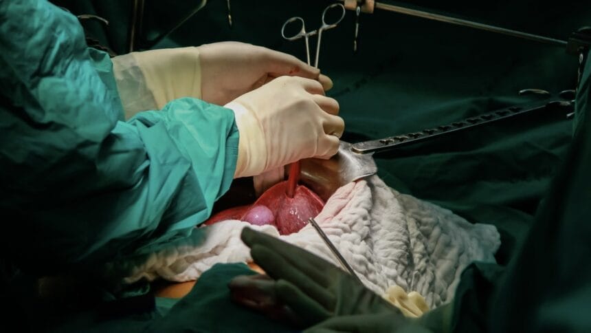 Transplantul hepatic