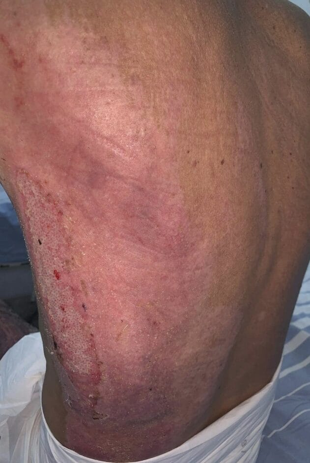 arsuri, mare ars, Rigenera,