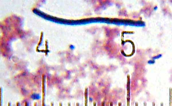 Lactobacillus delbrueckii subsp. bulgaricus