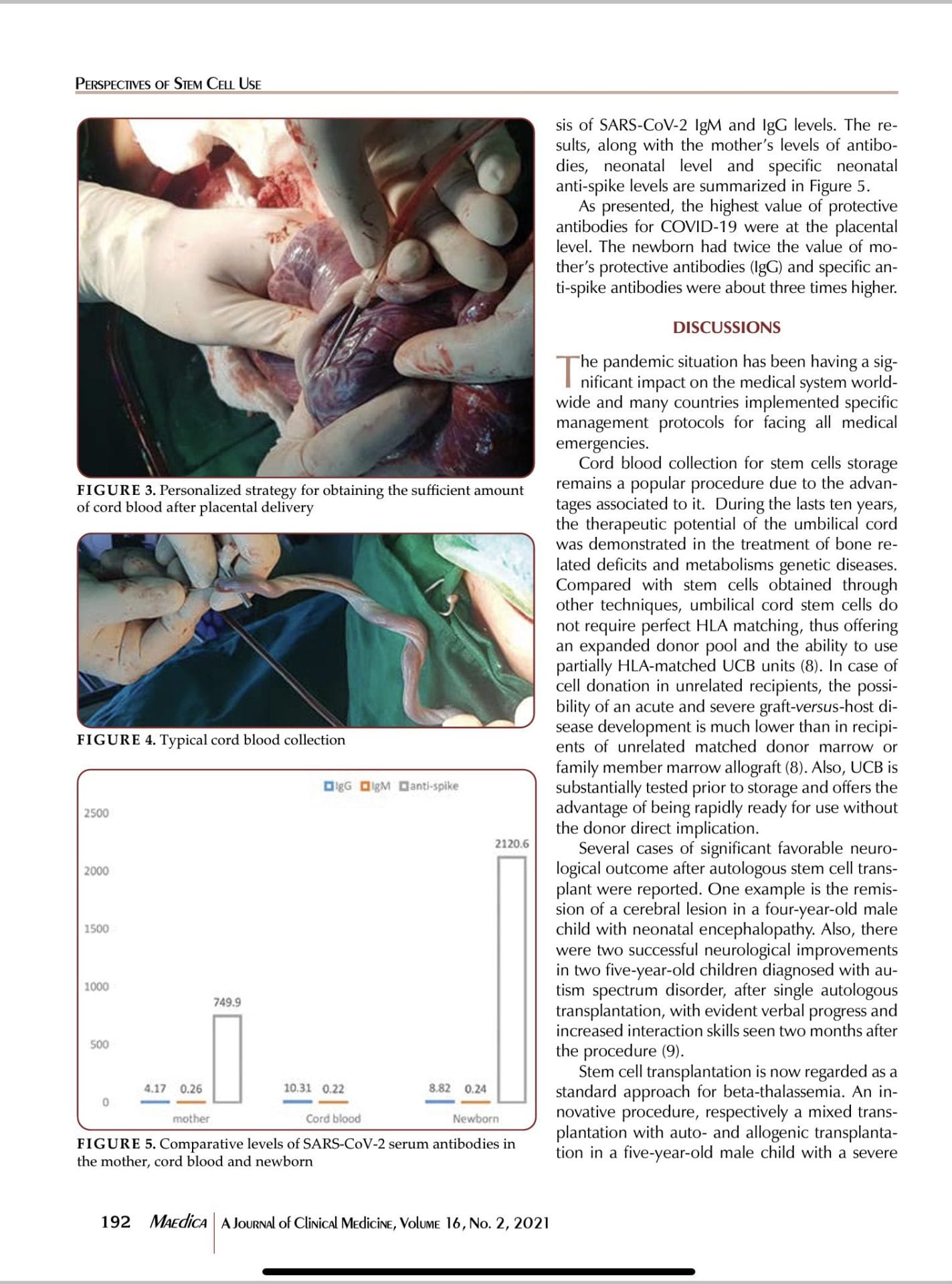 Studiu reff la nastere recoltare celule stem covid