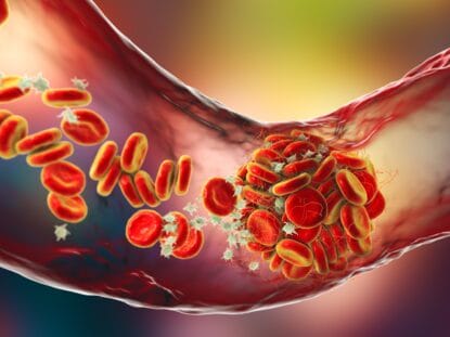 Trombofilie, gravida,