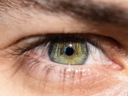 Dezlipirea de retina