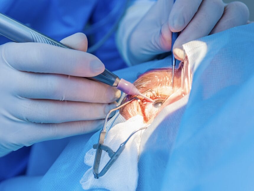 transplantul de cristalin, cataracta,