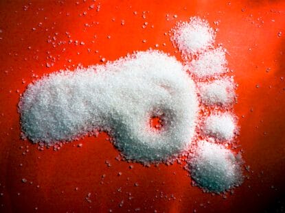 Picior diabetic, boala Buerger,