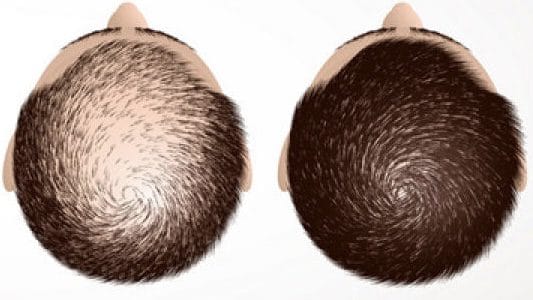 Rigenera, celule progenitorii,