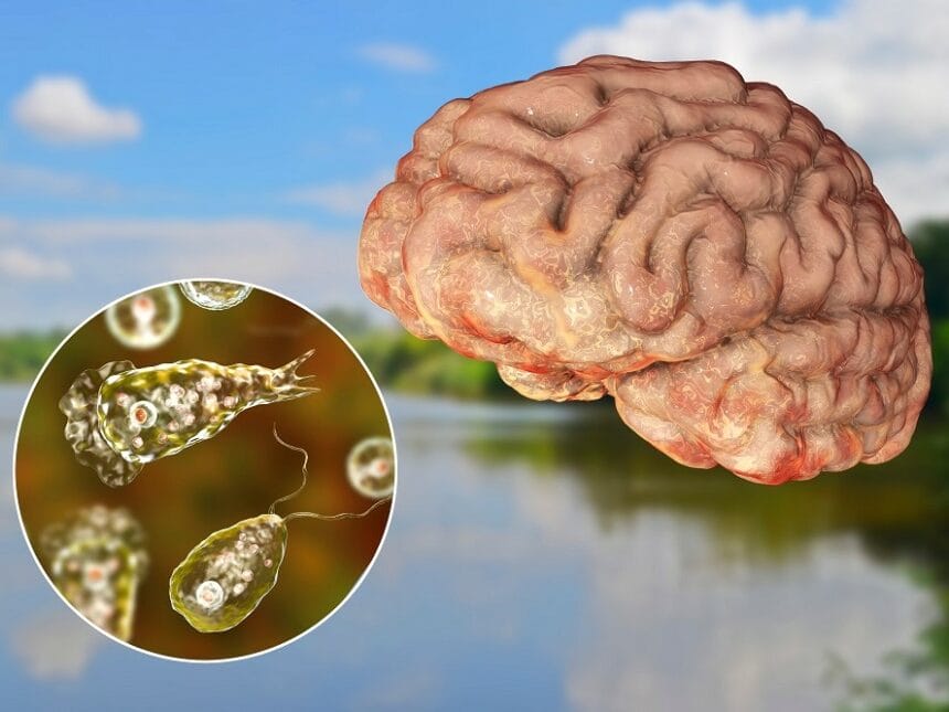 Naegleria fowleri, bacteria mancatoare de creier, bacterii, infectioase,