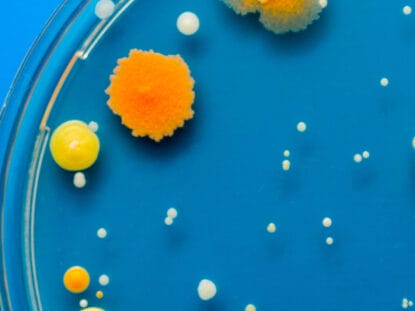 Proba, celule, stem, contaminata,