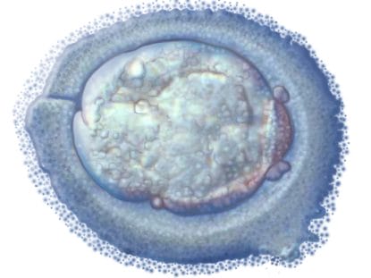 Celula umana, celule stem, Felician Stancioiu,