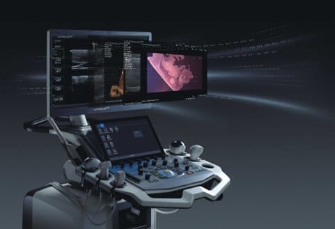 VINNO, ecografie, inteligenta artificiala,