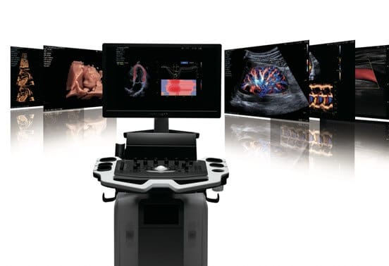 Diagnosticare imagistica, VINNO, ecograf, AI,