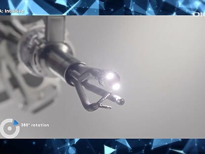 chirurgie robotica, Digipedia, da Vinci,