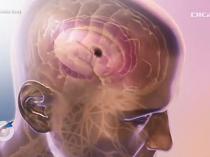 DIGIPEDIA, Alzheimer, dementa, neurologie, dr. Tudor Oprea,