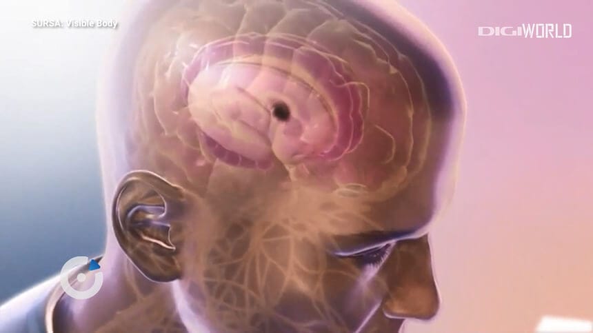 DIGIPEDIA, Alzheimer, dementa, neurologie, dr. Tudor Oprea,